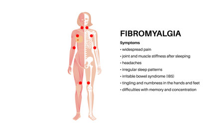 Fibromyalgia medical posterのイラスト素材