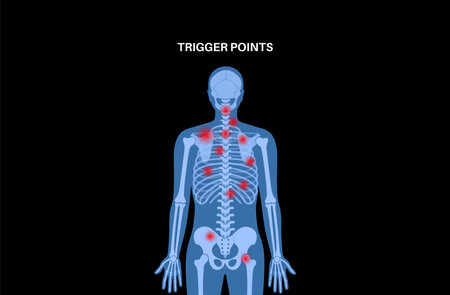Myofascial trigger pointsのイラスト素材