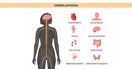 Ataxia cerebellar disorderのイラスト素材