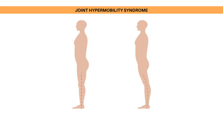 Joint hypermobility posterのイラスト素材
