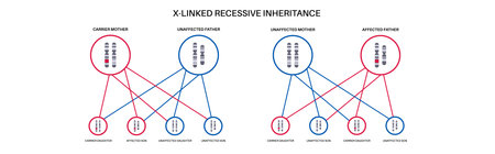 X linked recessive inheritanceのイラスト素材