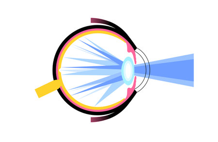 Cataract eye diseaseのイラスト素材