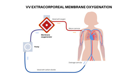 Extracorporeal membrane oxygenation