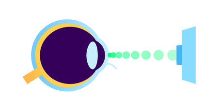 Lasik eye surgeryのイラスト素材