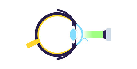 Lasik eye surgery
