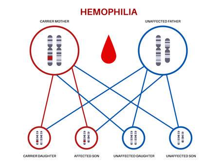 Hemophilia inheritance posterのイラスト素材