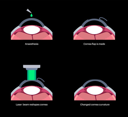 LASIK eye surgeryのイラスト素材