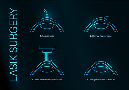 LASIK eye surgeryのイラスト素材