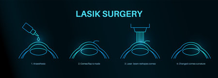 LASIK eye surgeryのイラスト素材