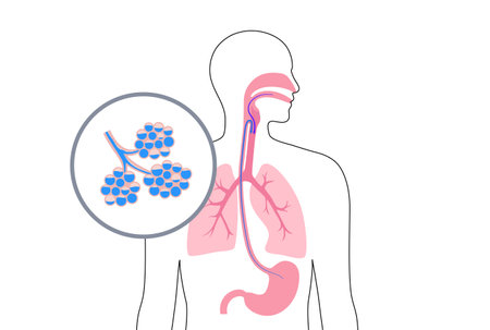 Aspiration pneumonia posterのイラスト素材