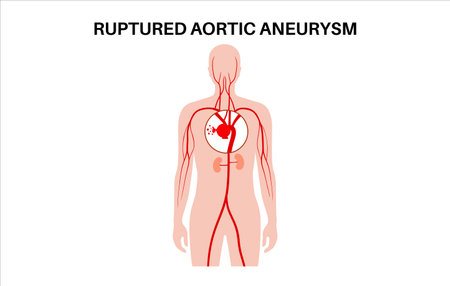 Ruptured thoracic aortic aneurysmのイラスト素材