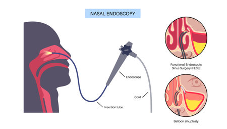 Nasal endoscopy poster