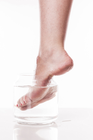 foot girl with a dry and rough skin and calluses on the heel moistened with water from the jar.の写真素材