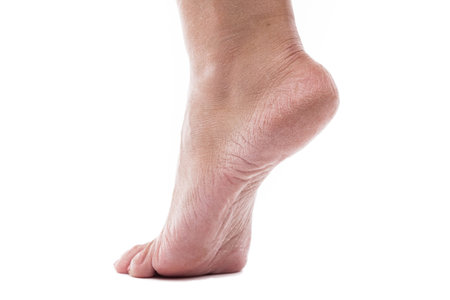 Dry heels woman on a white background close-up through a magnifying glassの写真素材