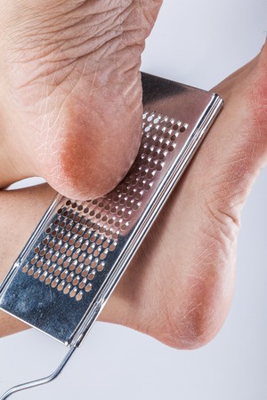 dehydrated skin on the legs, with a grater for heelsの写真素材