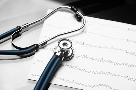 Cardiogram and blue medical stethoscope. Medical devices on the table at the doctor. concept of medicine and health care. stethoscope head lying on a cardiogram on a clipboard padの写真素材