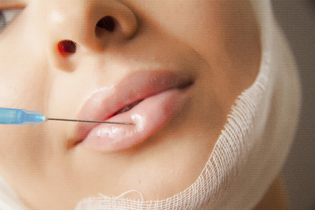 beautiful woman gets ijections with syringeの写真素材