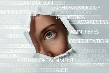 Blue eyed girl looking through ripped paper, conceptual ophthalmology tags blured on background. Template for eye care products design.の写真素材