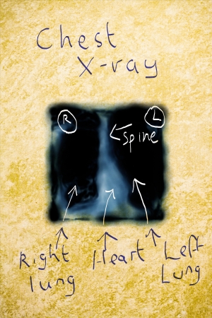 Annotated picture of a chest x-ray on a grungy piece of parchmentの写真素材