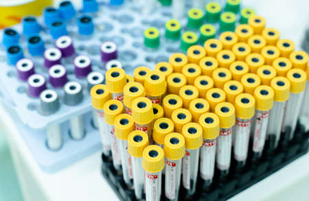 The test tubes in the laboratory are prepared for taking blood for coronavirus infection. COVID-19の写真素材