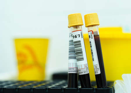 Tubes with blood tests for coronavirus infection. COVID-19. Pandemic virusの写真素材