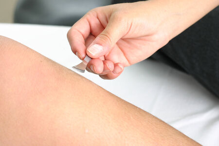 acupuncturist using a pine brushの写真素材