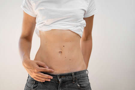 Fit sporty woman with abs and c-section scar. Postpartum recoveryの写真素材