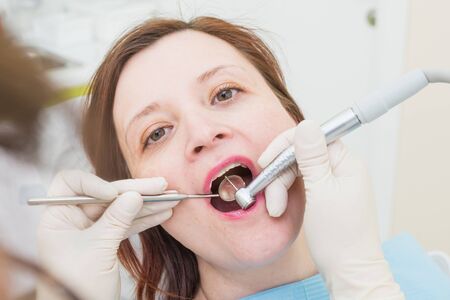 Middle aged woman patient at the dentist drilling the tooth with a turbine and making dental fillings, closeup.の写真素材