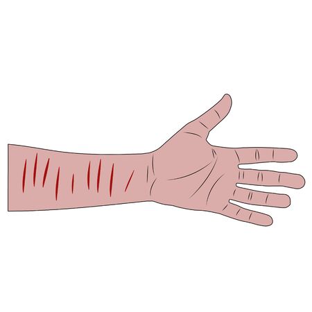 male hand with bloody cuts on the wrist after suicide attempt. isolated cartoon stock vector illustrationのイラスト素材