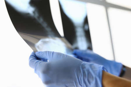Doctor in gloves holds x-rays to light closeup.