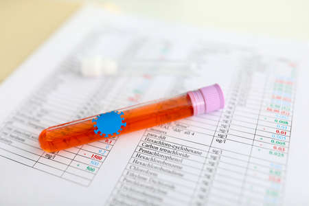 On document with test results is test tube with liquid from coronavirusの写真素材