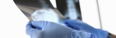 Doctor in gloves holds x-rays to light closeup.の写真素材