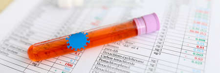 On document with test results is test tube with liquid from coronavirusの写真素材