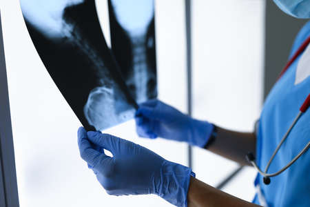 Doctor with gloves holds two x-rays closeupの写真素材