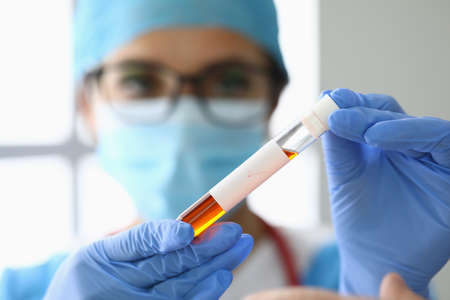 In hands in protective gloves doctor holds test tube with liquid.の写真素材