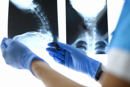 Doctors hands holding X-rays of cervical spine.の写真素材