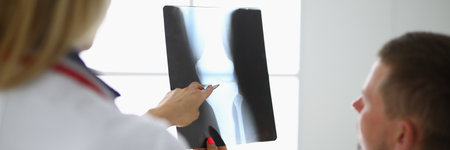 Doctor and the patient are looking at X-rayの写真素材