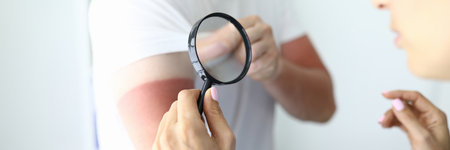 Nurse holds her hand and looks at sunburn on her handの写真素材