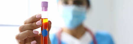 Doctor holds in his hands a test tube with liquid with bacterium stickerの写真素材