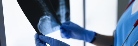 Doctor with gloves holds two x-rays closeupの写真素材