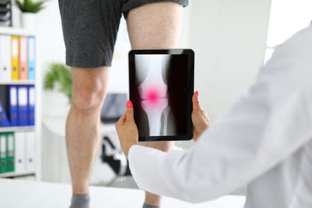 Traumatologist is holding tablet near patients sore leg in the clinic closeup.の写真素材