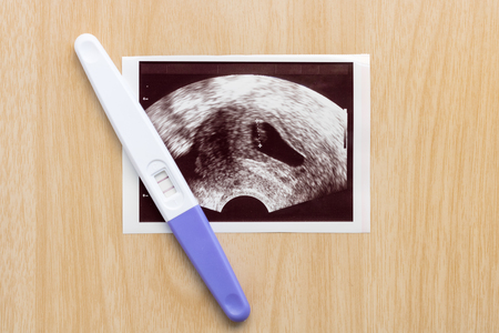Pregnancy test with ultrasound picture of baby on wooden background. Pregnancy care concept.の写真素材