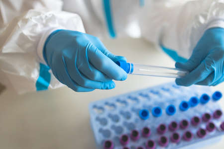 Process of coronavirus PCR antigen testing examination by nurse medic in laboratory lab, COVID-19...