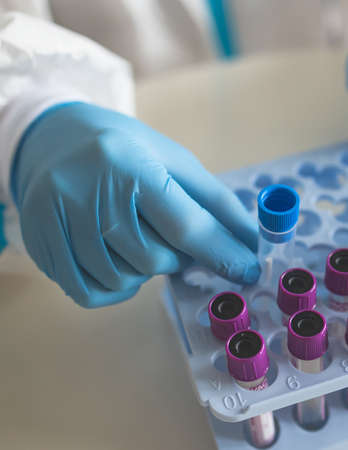 Process of coronavirus PCR antigen testing examination by nurse medic in laboratory lab, COVID-19...