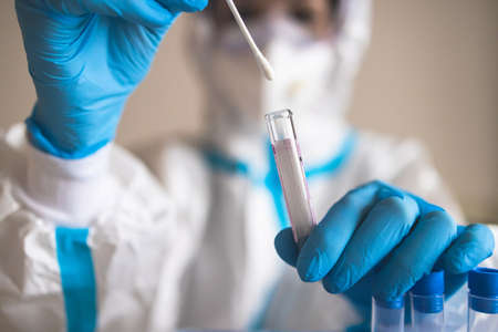 Process of coronavirus PCR antigen testing examination by nurse medic in laboratory lab, COVID-19 swab collection kit, test tube for taking OP NP patient specimen sample, patient receiving a testの写真素材
