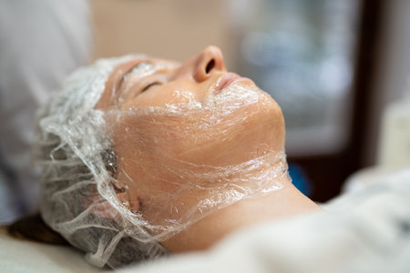 close-up of a girl's face at a cosmetologist during treatment proceduresの写真素材