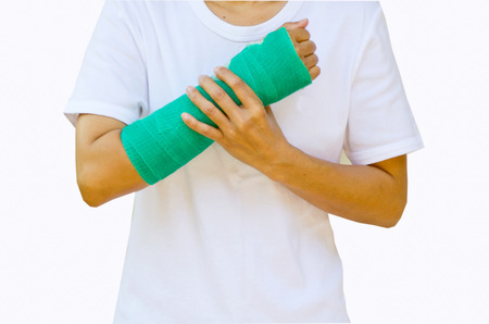 green cast on hand and arm の写真素材