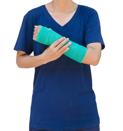 green cast on hand and arm isolated on white backgroundの写真素材