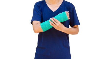 green cast on hand and arm on white background.の写真素材
