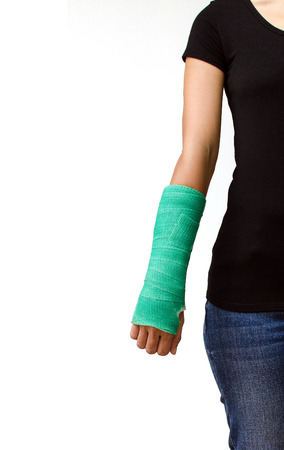 green cast on hand and arm isolated on white background.の写真素材